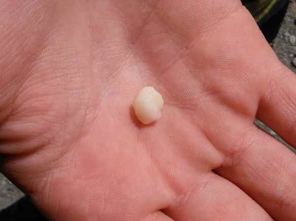 Cole's tooth he lost in Canada.